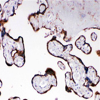 Cytochrome P450 Reductase/POR Rabbit Polyclonal Antibody