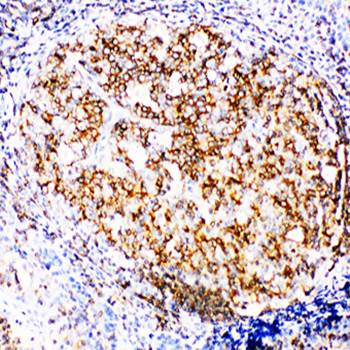 RIAM/APBB1IP Rabbit Polyclonal Antibody