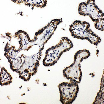CUEDC2 Rabbit Polyclonal Antibody