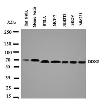 DDX5 Rabbit Polyclonal Antibody