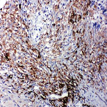 LTBR Rabbit Polyclonal Antibody