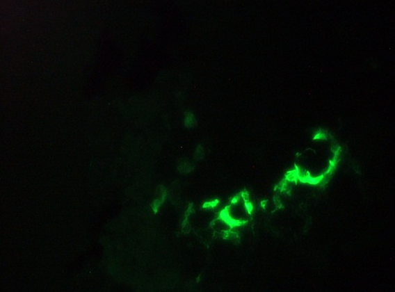 Mouse annexin V Antibody