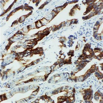 Cytochrome P450 2U1 CYP2U1 Rabbit Polyclonal Antibody