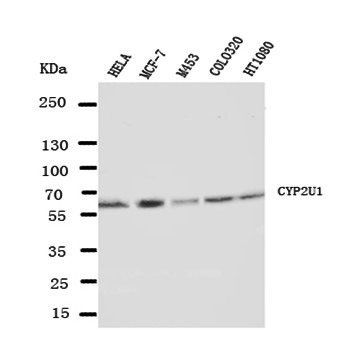 Cytochrome P450 2U1 CYP2U1 Rabbit Polyclonal Antibody
