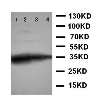 GCN2/EIF2AK4 Rabbit Polyclonal Antibody