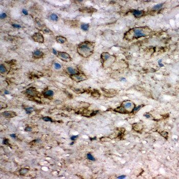 integrin beta 4 binding protein/EIF6 Rabbit Polyclonal Antibody