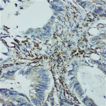 integrin beta 4 binding protein/EIF6 Rabbit Polyclonal Antibody