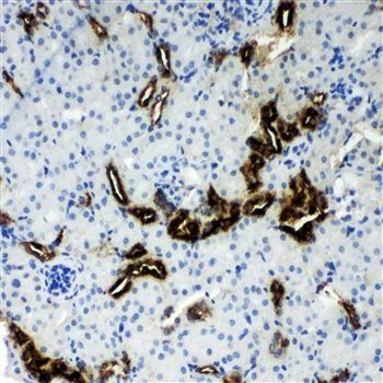 Kallikrein 1/KLK1 Rabbit Polyclonal Antibody