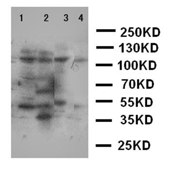 Phospholipase A2/PLA2G4A Rabbit Polyclonal Antibody