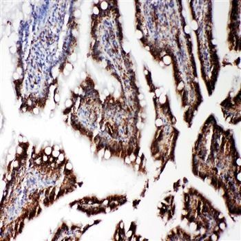 RGS3 Rabbit Polyclonal Antibody