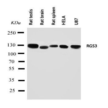 RGS3 Rabbit Polyclonal Antibody