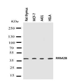 p53R2/RRM2B Rabbit Polyclonal Antibody