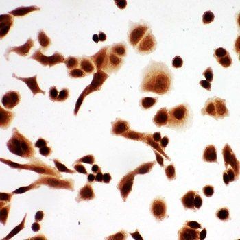 p63/TP63 Rabbit Polyclonal Antibody
