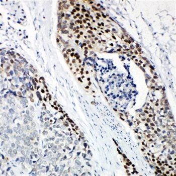p63/TP63 Rabbit Polyclonal Antibody
