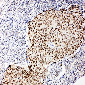 p63/TP63 Rabbit Polyclonal Antibody
