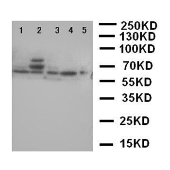 p63/TP63 Rabbit Polyclonal Antibody