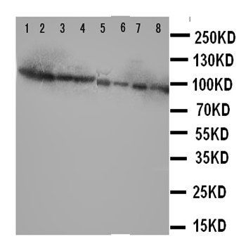 Factor VIII/F8 Rabbit Polyclonal Antibody