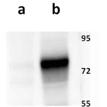 Anti-ORF14 (VZV) antibody