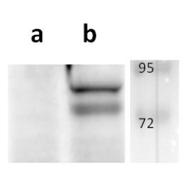 Anti-ORF54 (VZV) antibody