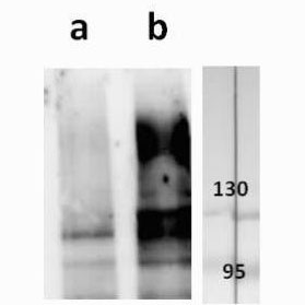 Anti-ORF62 (VZV) antibody