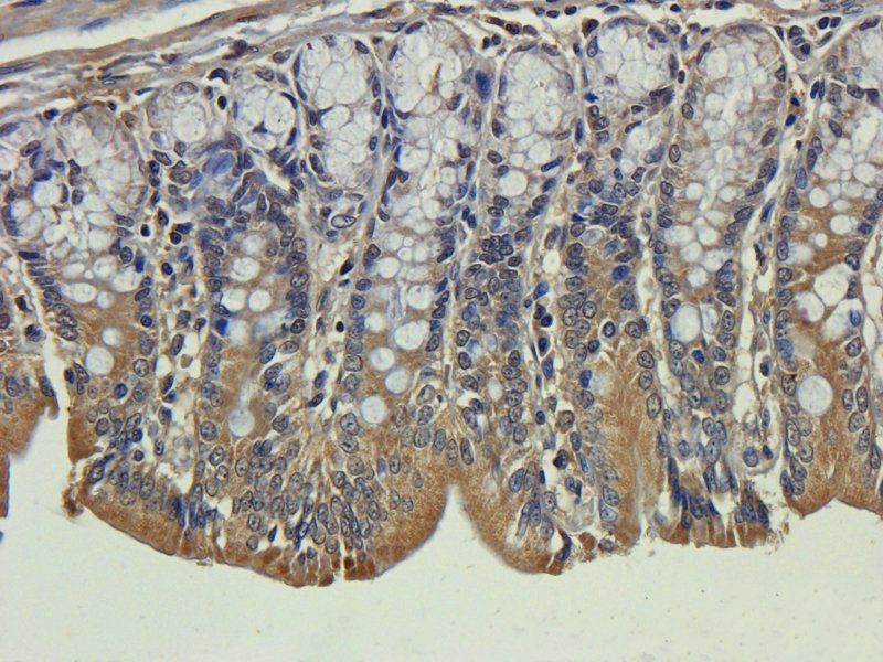 ORM1 Rabbit Polyclonal Antibody