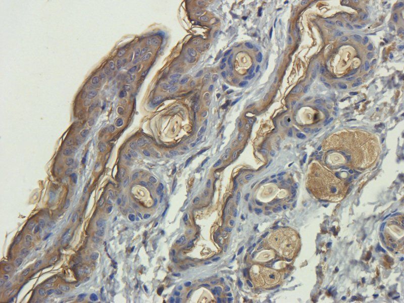 ORM1 Rabbit Polyclonal Antibody