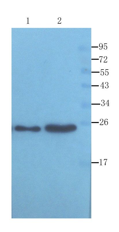 ORM1 Rabbit Polyclonal Antibody