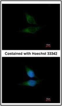 ORP1 Rabbit Polyclonal Antibody