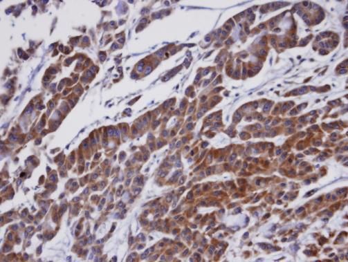 ORP1 Rabbit Polyclonal Antibody