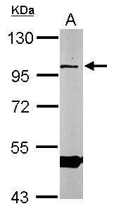 ORP1 Rabbit Polyclonal Antibody