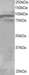 ORP11/OSBPL11 Antibody