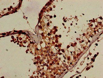 OS9 Antibody