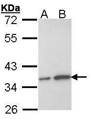 OTUB1 Rabbit Polyclonal Antibody