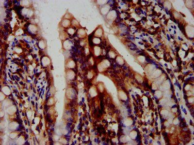OTUD7B Antibody