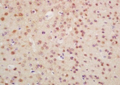 OTX1 + OTX2 Rabbit Polyclonal Antibody