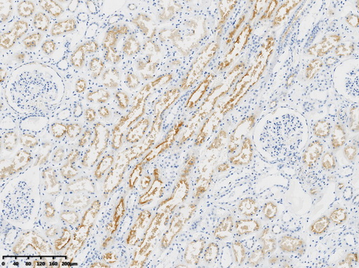 P Glycoprotein Antibody