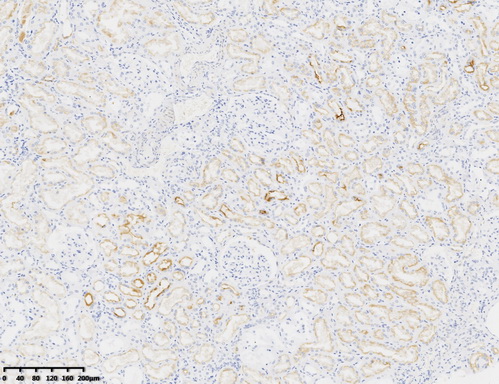 P Glycoprotein Antibody
