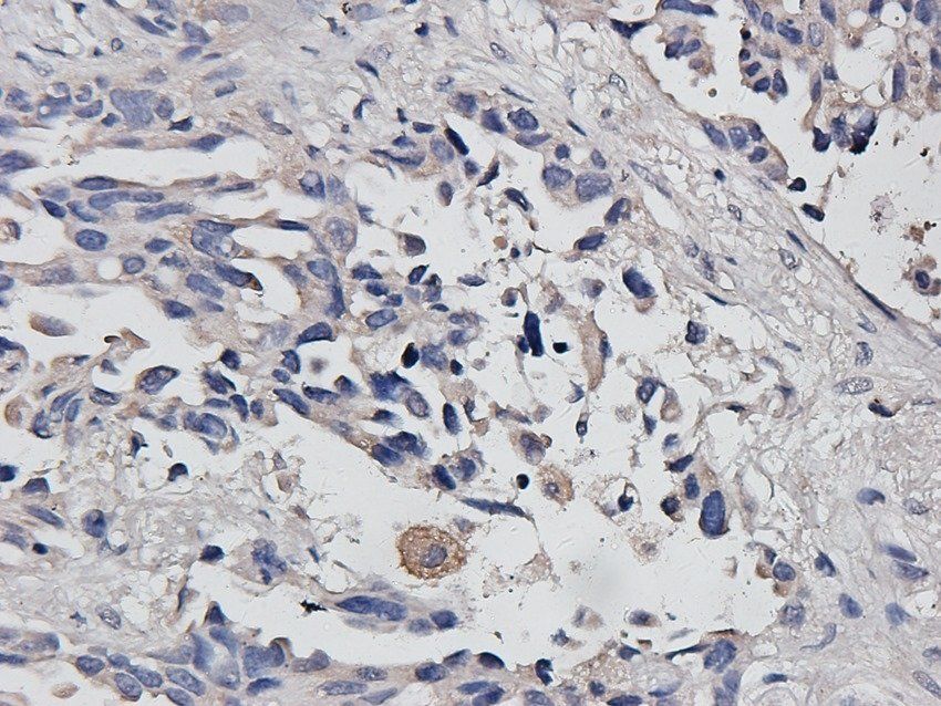 p-Selectin Rabbit Polyclonal Antibody