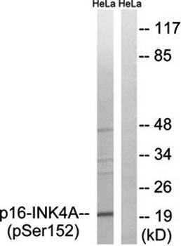 p16-INK4a (Phospho-Ser152) Antibody