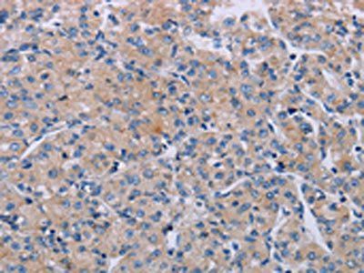 P2RX3 Antibody
