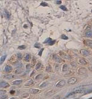 P311 Rabbit Polyclonal Antibody