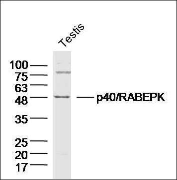 P40/RABEPK Rabbit Polyclonal Antibody