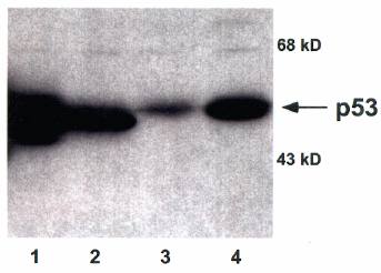 Sheep anti Human p53 Antibody
