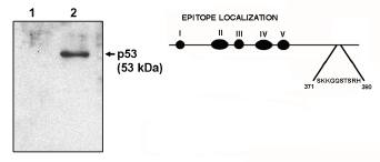 Mouse anti Human p53 (a.a. 371-380) Antibody