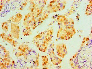 TP53 Antibody