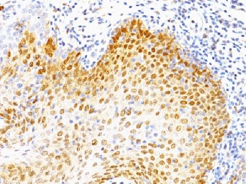 TP53 Antibody