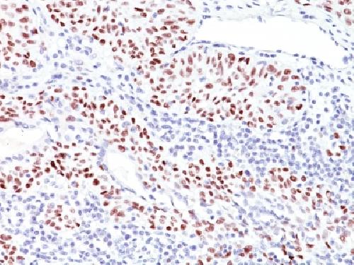 TP53 Antibody