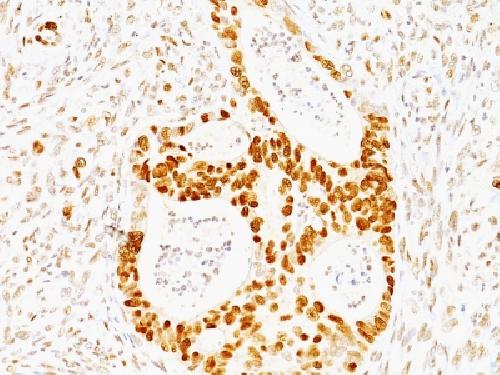 TP53 Antibody