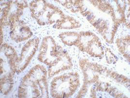 TP53 Antibody