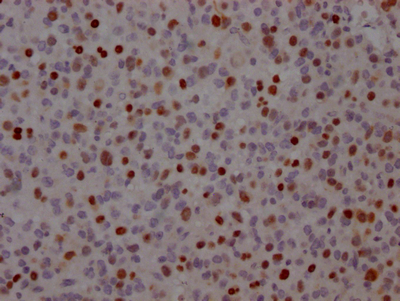 TP53 Antibody